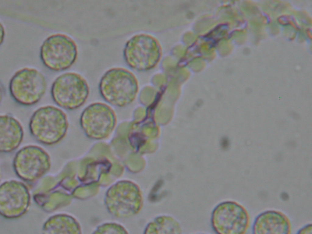 Lycogala epidendrum (J.C. Buxb. ex L.) Fr.(PROVA)